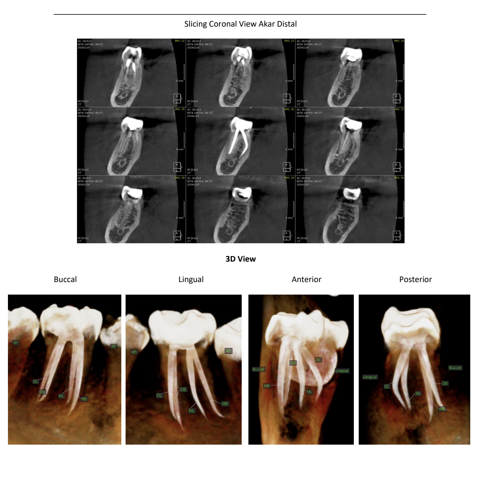 Radiologi Dental dalam Perawatan Endodontik